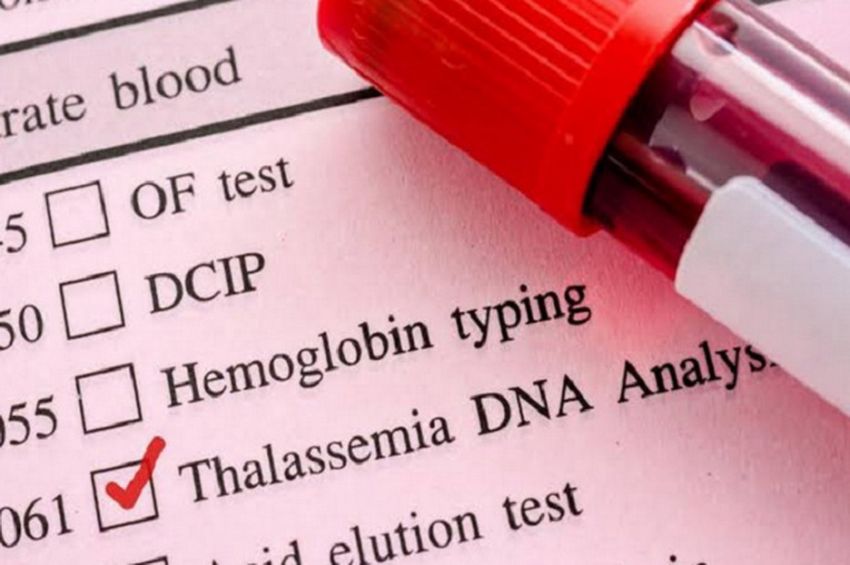Jangan Sampai Keliru Ini Perbedaan Thalassemia Dan Anemia