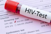 Tes HIV Harus Dilakukan Pemain Film Dewasa, Begini Cara Kerjanya