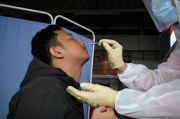 Guru Besar FKUI: Kasus Covid-19 di Indonesia Turun karena Rendahnya Tes Antigen