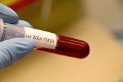 Epidemiologi Sebut Virus Zika Bisa Menular Lewat Hubungan Seksual