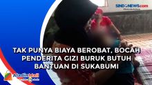 Tak Punya Biaya Berobat, Bocah Penderita Gizi Buruk Butuh Bantuan di Sukabumi