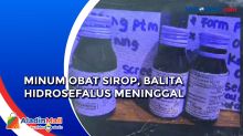 Balita Hidrosefalus Meninggal Usai Minum Obat Sirop karena Demam di Jakarta