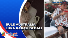 Viral! Turis Australia jadi Korban Pemukulan di Bali, Polisi Sebut Luka Akibat Kecelakaan