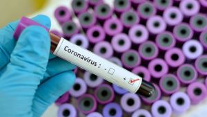 Vaksin Covid-19 Buatan Kalbe Farma Ditarget Mulai Distribusi Pertengahan 2021