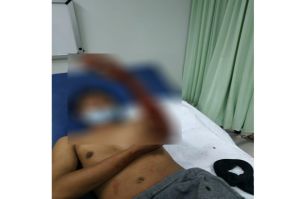 Dicelurit Komplotan Begal HP di Bintaro, Tangan Driver Ojol Luka Menganga