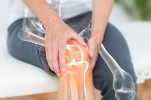 Usia 30 Tahun Rawan Osteoporosis, Dokter Ungkap Cara Mencegahnya