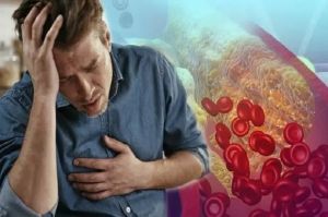 Gejala Kolesterol Tinggi yang Berbahaya, Diam-Diam Bisa Sebabkan Serangan Jantung