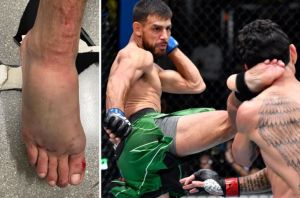 Brutal! Kaki Petarung UFC Patah Dilarikan ke RS Usai Duel UFC Berdarah