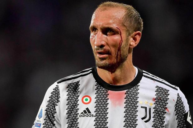 Cucuran Darah Akhiri Karier Chiellini di Juventus dan Liga Italia