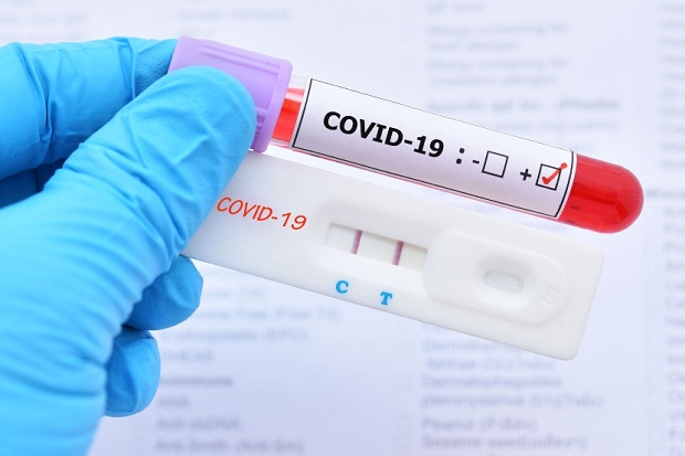 Hasil Tes Antigen Negatif tapi PCR Positif Covid-19, Mana yang Benar?