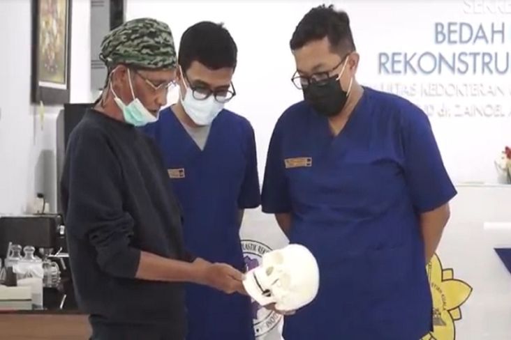 Kisah Dokter Dermawan dari Aceh, Operasi 5.000 Anak Sumbing Tanpa Biaya