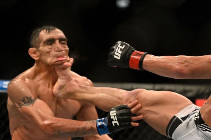 Wajah Petarung UFC Rusak Ditendang Musuhnya Dilarikan ke Rumah Sakit