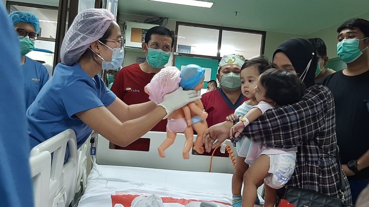 Tim Dokter RSHS Berhasil Pisahkan Bayi Kembar Siam Zaina-Zahira