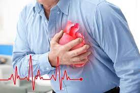 Kematian Akibat Jantung Tinggi, Dokter Sebut Mayoritas Pasien Datang Terlambat