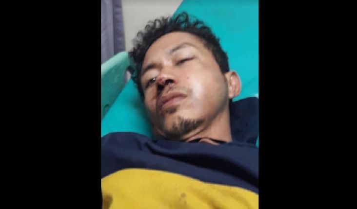 Babak Belur Jadi Korban Salah Tangkap Polisi, Aidil Lapor ke Propam Polda Sumsel