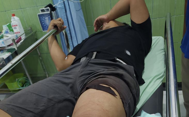 Asyik Makan Kupang, 3 Pemuda Dikeroyok Puluhan Orang Berbaju Hitam secara Brutal