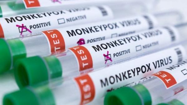 Vaksin Cacar Monyet Tak Melindungi 100 Persen, Ini Kata Satgas Monkeypox IDI