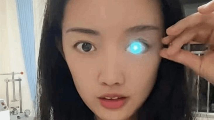 Wanita China Ini Gunakan Mata Bionik yang Bisa Bersinar