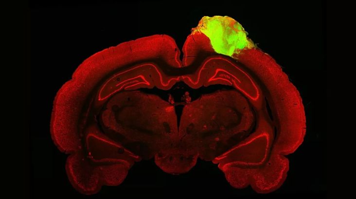Ilmuwan Sukses Transplantasi Otak Manusia Buatan ke Kepala Tikus