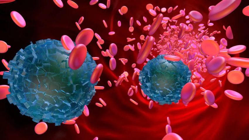 Ilmuwan Temukan Mikroplastik di Jaringan Pembuluh Darah Manusia