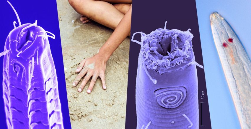 Mengenal Nematoda, Cacing Gelang Alien Parasit yang Hidup di Pantai Berpasir