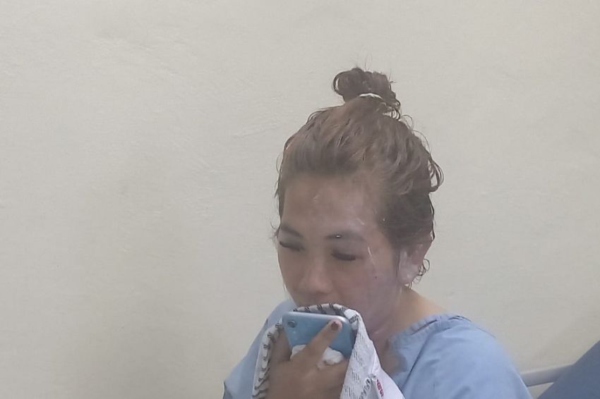 Memilukan! Wanita Cantik di Palembang Terluka Parah Disiram Air Keras