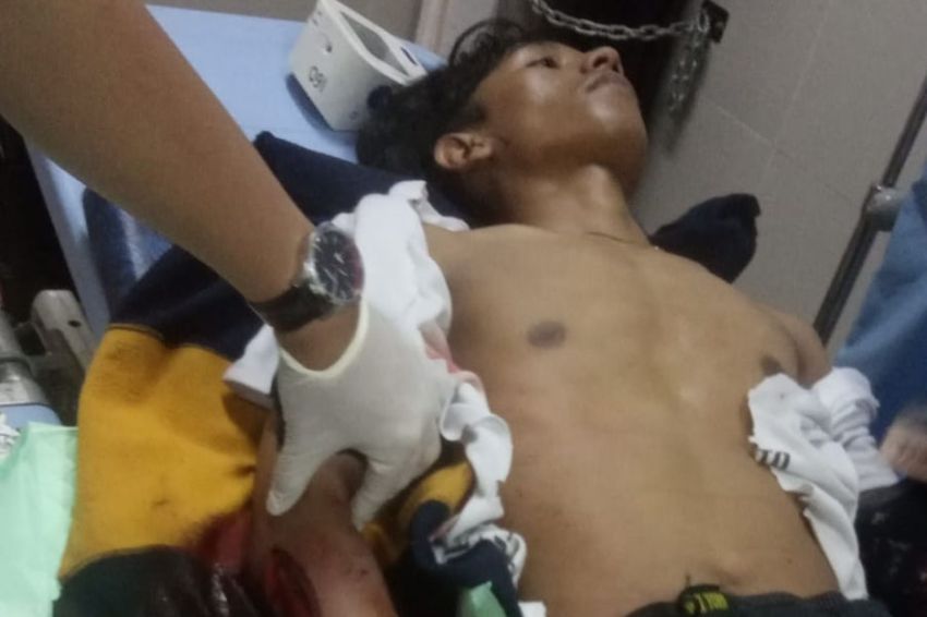 Bentrokan Antar Geng di Tangerang Putuskan Lengan Pemuda, 2 Pelaku Dibekuk