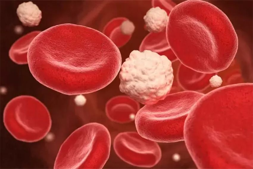 Saling Terkait, Apakah Gula Darah Sama dengan Diabetes?