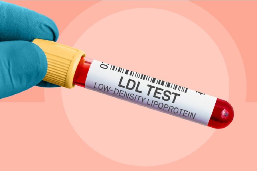 Understanding the Subtypes and Dangers of Small Dense Bad Cholesterol: Effects on Heart Health