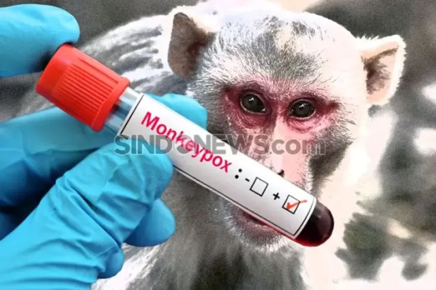 Tekan Penyebaran Kasus Monkeypox, Dinkes DKI Lacak Kontak Erat