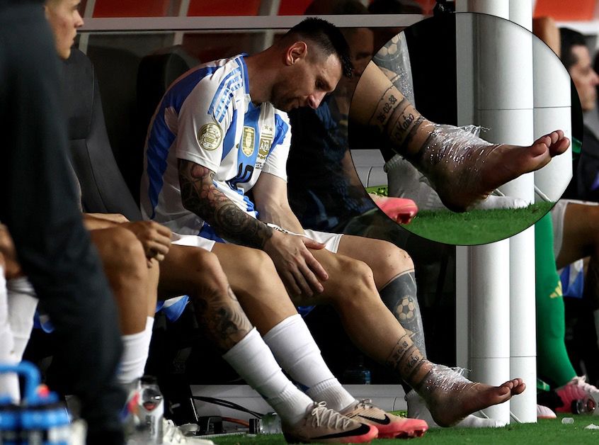 Kaki Lionel Messi Dibungkus Plastik Korban Keganasan Final Copa America 2024