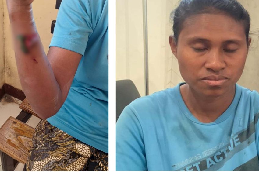 Gegara Mabuk Miras, Pria di Timor Tengah Utara Nekat Bacok Lengan Istri