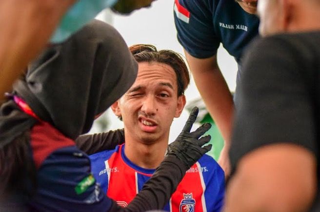 Pemain Unggul FC Cedera Wajah Serius saat Lawan Giga FC