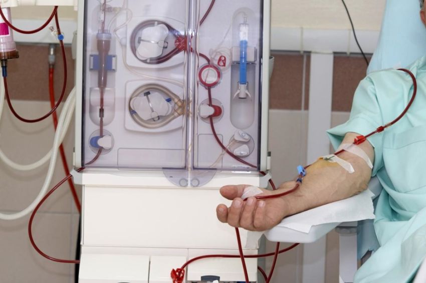 Apakah Hemodialisis dan Cuci Darah Sama? Ini Penjelasannya