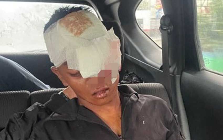 Prajurit TNI di Medan Luka Parah Dianiaya Geng Motor, Polisi Buru Pelaku