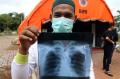 365 Hari Lawan Covid-19 : Masuknya Virus Mematikan ke Indonesia