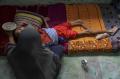 Derita Gizi Buruk Sejak Umur 5 Bulan, BB Iqbal Kini Hanya 12 Kg di Umur 19 Tahun