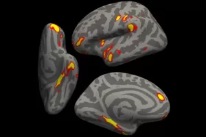 Benarkan COVID-19 Mengubah Struktural Otak Manusia? Begini Penjelasan Para Ahli