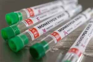 Vaksin Varicella 85% Efektif Cegah Cacar Monyet, namun Mendapatkannya Tidak Gratis