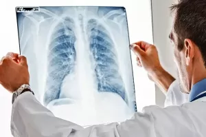 Cara Tepat Menjaga Kesehatan Paru-paru, Ini Penjelasan Ahli