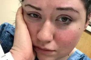 Wanita Ini Habiskan 23 Jam di Tempat Tidur Gara-Gara Idap Alergi Gravitasi