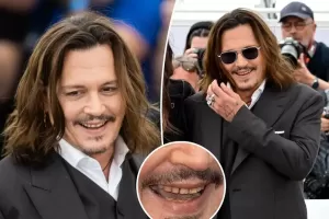 Penampilan Johnny Depp di Cannes Film Festival Jadi Sorotan, Giginya Diduga Busuk